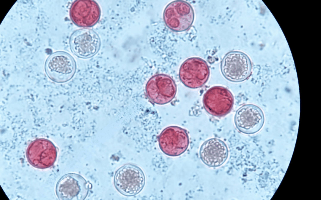 Nausea and Cramps That Won’t Quit: A Guide to Cyclosporiasis